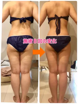 ロング カラー パーマ ヘアアレンジ メンズ キッズ ネイル マツエク・マツパ ‍痩身＆ボディ 結果出し🌟丹野のエステ・リラクイメージ