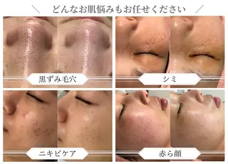 肌質改善サロン BestBelleのエステ・リラクイメージ