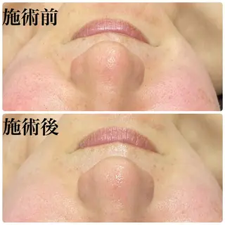 ハーブピーリング専門店 Ribboｰn所属・川田 弥生のエステ・リラクイメージ