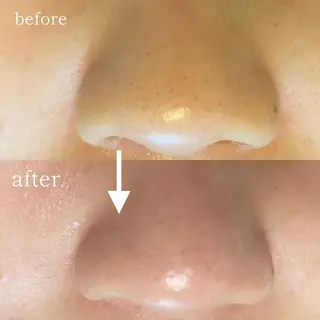 毛穴専門サロン　フルール所属・フルールFululu 自由が丘のエステ・リラクイメージ