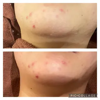 セミロング カラー パーマ ヘアアレンジ メンズ キッズ ネイル マツエク・マツパ アイブロウ ニキビ特化型エステ 🍓最短で肌質改善のエステ・リラクイメージ