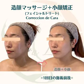 小顔矯正☀︎バスト ☀︎ハルのエステ・リラクイメージ