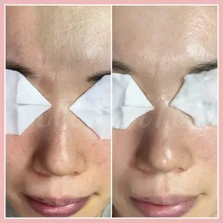 kanunu♡mana所属・豊橋/毛穴特化エステ 深層デトックスリンパのエステ・リラクイメージ