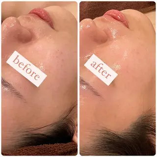 立体小顔×艶肌×美ボ ディ似合わせ施術 岡のエステ・リラクイメージ