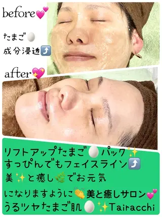 Tairacchi ﾀｲﾗｯﾁのエステ・リラクイメージ