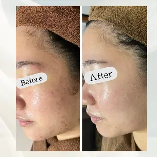 Safari Bloom所属・Safari Bloomのエステ・リラクイメージ