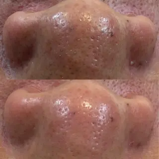 By color  EYE&NAIL所属・BY  COLOR eyedesinのマツエク・マツパデザイン