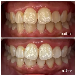 DH. MISATOの眉毛・アイブロウイメージ