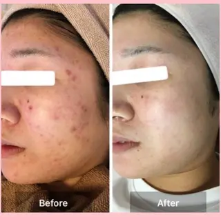 ハーブピーリング 専門店Kikkaのエステ・リラクイメージ