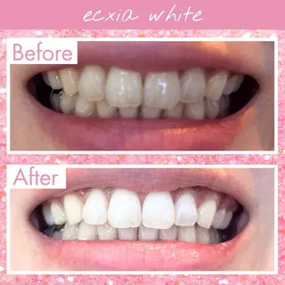 セルフホワイトニング エクシア西宮北口店所属・セルフホワイトニング エクシア西宮北口店のその他イメージ