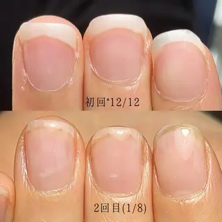 ネイル Aim* 深爪・自爪育成専門店のネイルデザイン