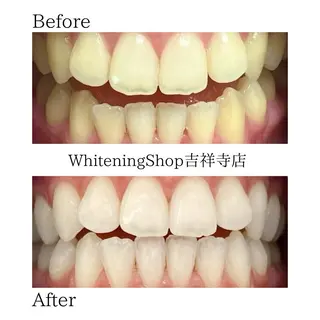 ホワイトニング ショップ吉祥寺店のエステ・リラクイメージ