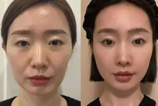 aliaハイフ&水光ジェットサロン所属・aliaハーブ水光店 エステティシャン募集のエステ・リラクイメージ