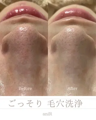 北浜/毛穴洗浄ツヤ肌 サロンaniRのエステ・リラクイメージ