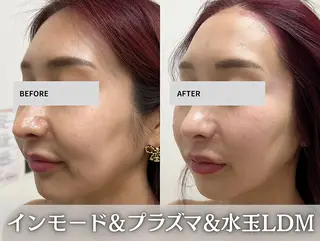 aimer 佐々木のエステ・リラクイメージ