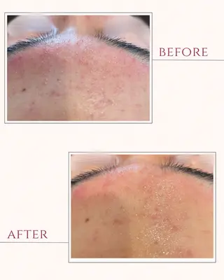 AY'S所属・倉敷/玉島/毛穴洗浄 古川碧のエステ・リラクイメージ