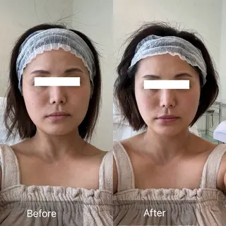 Charis エステ&ネイルのエステ・リラクイメージ