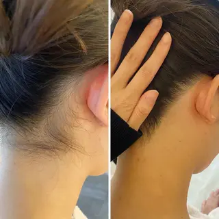 うなじ脱毛/美肌脱毛 LABELのエステ・リラクイメージ