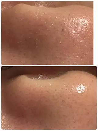 Lien オーナー　山口智嘉のエステ・リラクイメージ