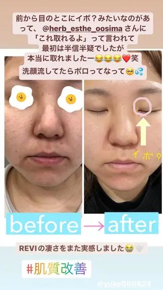 肌育脱毛サロン LikoLinaのその他イメージ