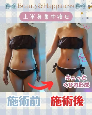 痩身ハーブピーリング 筋膜リリース☆B&Hのエステ・リラクイメージ