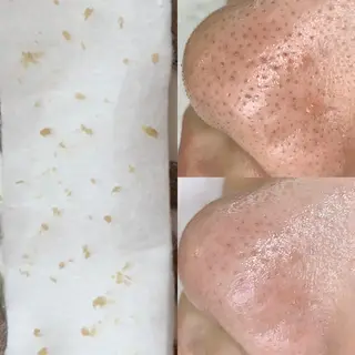 メンズ メンズ脱毛&メンズ眉毛  美的男子所属・メンズ眉＆メンズ脱毛 美的男子のその他イメージ