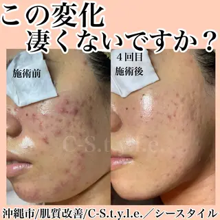 エステサロン C- S.t.y.l.e.のエステ・リラクイメージ