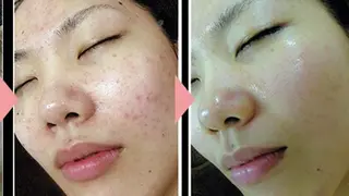 ☺ハーブピール💕 ソフィアカロン💖のエステ・リラクイメージ