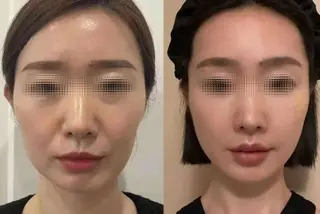 マツエク・マツパ aliaハイフ&水光ジェットサロン所属・aliaハーブ水光店 エステティシャン募集のエステ・リラクイメージ