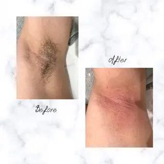 Cielo 上野店のエステ・リラクイメージ