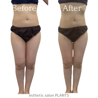 esthetic salon PLANTS所属・エステティックサロン PLANTSのエステ・リラクイメージ