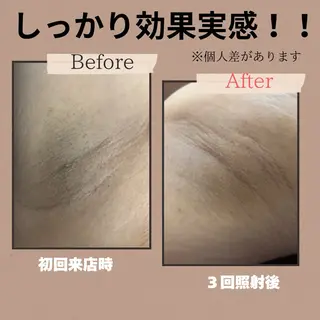 lieupré 脱毛 oshima‎⌣̈のエステ・リラクイメージ