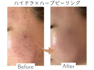 プライベートサロン Belle(ベル)のエステ・リラクイメージ