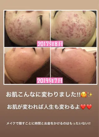 ミディアム カラー パーマ ヘアアレンジ メンズ キッズ ネイル マツエク・マツパ ニキビ・肌質改善専門 ♡人生が変わるサロンのエステ・リラクイメージ