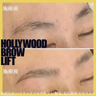 アイブロウ epismoo 脱毛/HBL/毛穴の眉毛・アイブロウイメージ