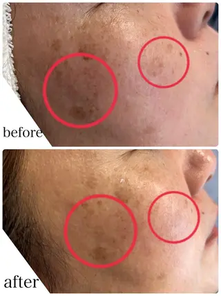 N.style所属・Ｎ. styleのネイルデザイン