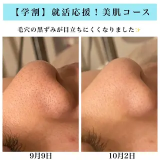 Bellesthe （ベルエステ）のエステ・リラクイメージ