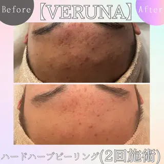 ニキビ改善専門店 d'Albaのエステ・リラクイメージ