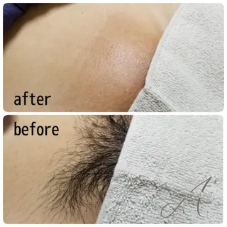 A*《エースター》 シュガーリング🍋のエステ・リラクイメージ