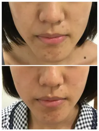 武蔵浦和　小顔矯正 リーフ　　武蔵浦和店のエステ・リラクイメージ