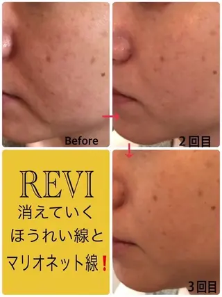 山崎 陽子のエステ・リラクイメージ