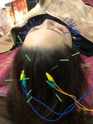 美容鍼灸女性専用 りんご鍼灸治療院のエステ・リラクイメージ