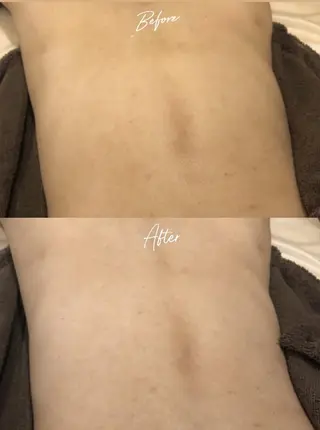 美肌脱毛/肌質改善 《ulula～梟》のエステ・リラクイメージ