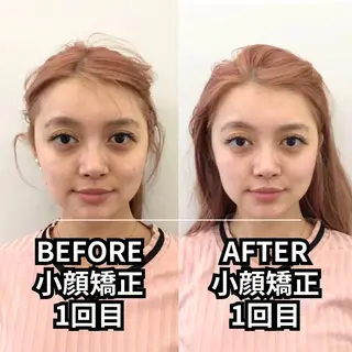 小顔矯正/美容整体 /骨盤矯正✨+Mi2のエステ・リラクイメージ