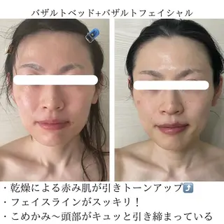 LA・PUR所属・LA・ PURのエステ・リラクイメージ