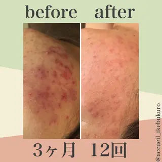 ミディアム カラー パーマ ヘアアレンジ メンズ キッズ ネイル マツエク・マツパ ニキビ・肌質改善専門 ♡人生が変わるサロンのエステ・リラクイメージ