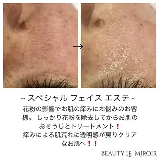 ビューティー ミロワールのエステ・リラクイメージ