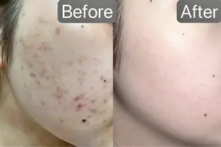 Belleつくば店所属・鈴木 華咲のエステ・リラクイメージ