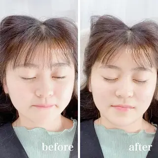 はり灸サロン　totonoi所属・印象の良くなる 美容鍼のエステ・リラクイメージ