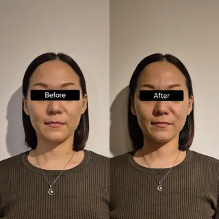 小顔矯正 LNのエステ・リラクイメージ